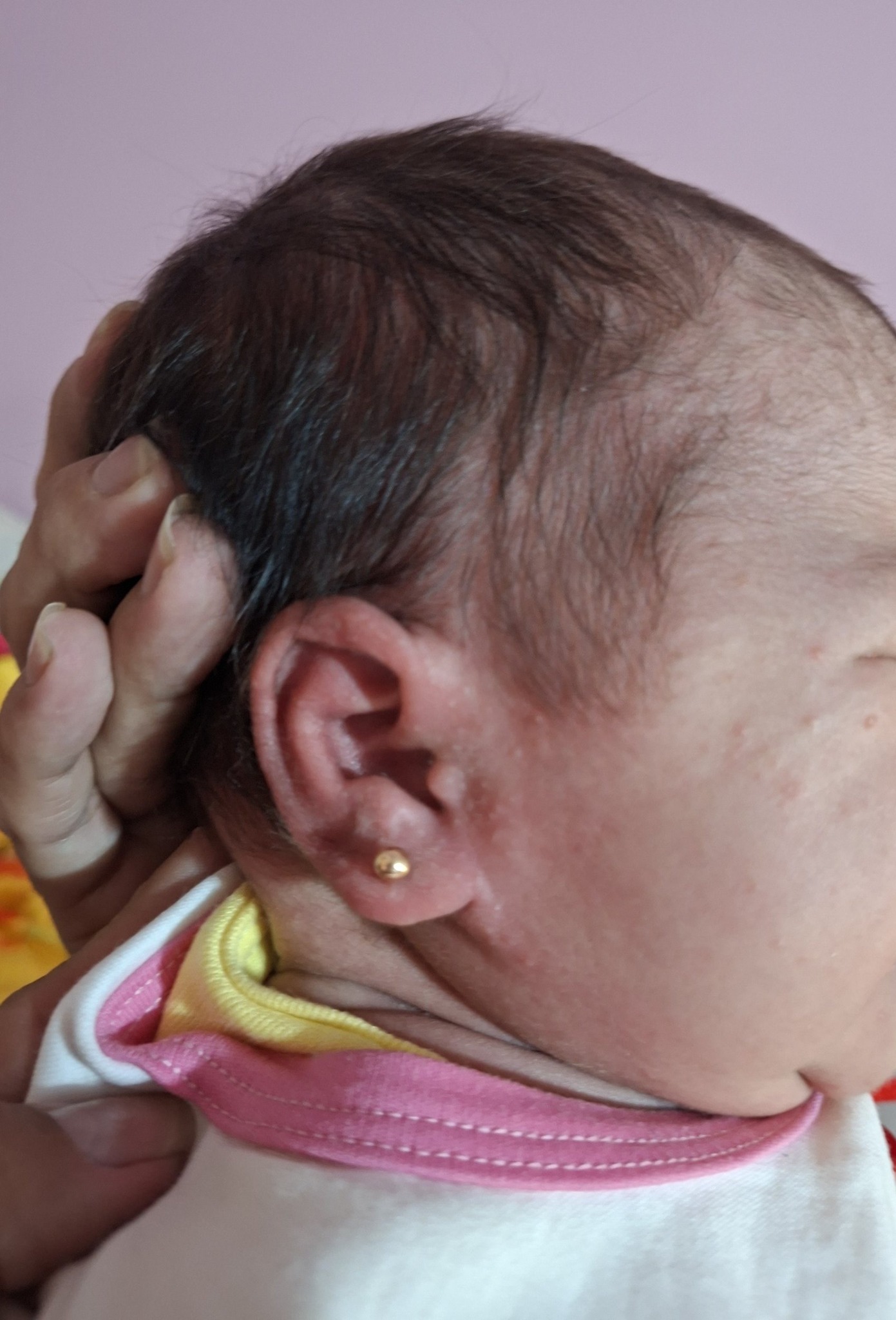 Bebé con aro bolita de oro